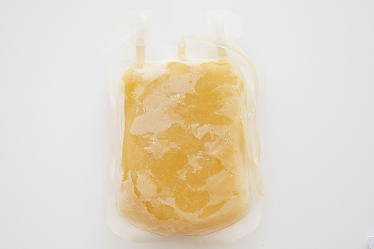 captivate bio human platelet lysate hpl