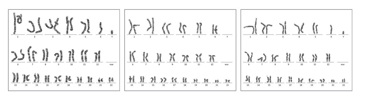 extracellular matrix karyotyping data