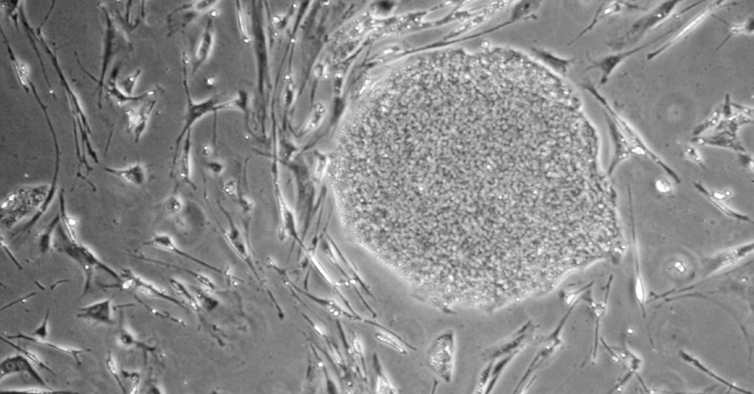 Morphology of hESCs grown on feeders after sorting with application of Y-27632
