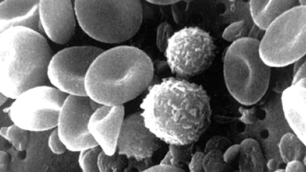 hematopoietic stem cells