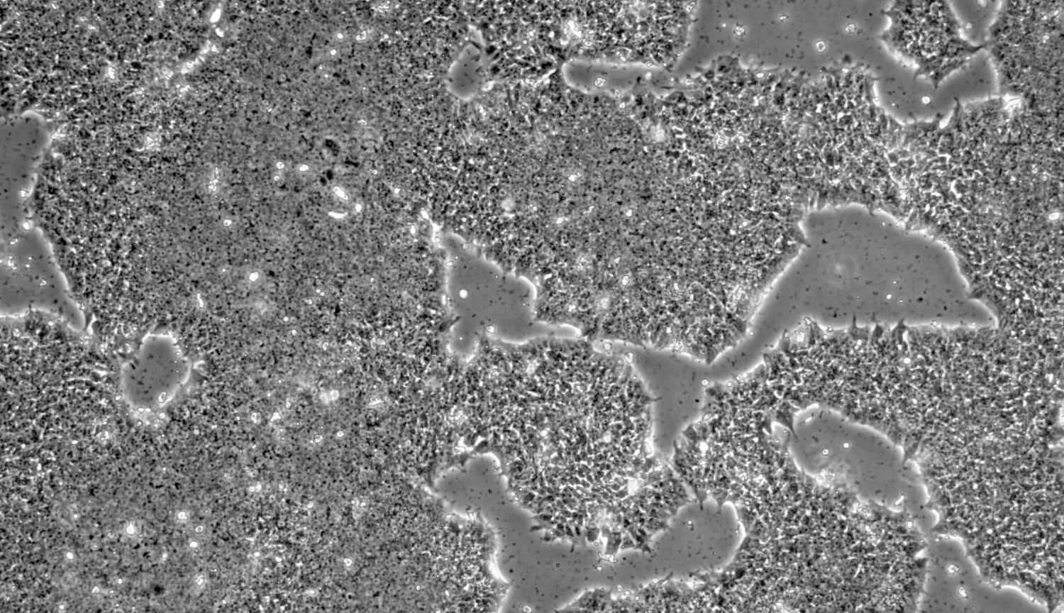 EverCell Bio hPSCs cultured with ROCK Inhibitors, CET day 3