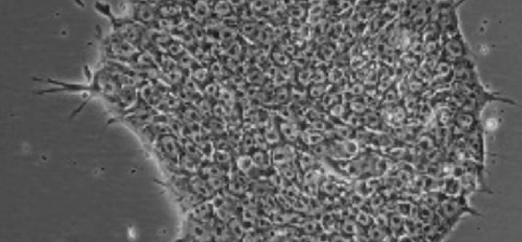hpscs derived using CET Cocktail by Captivate Bio